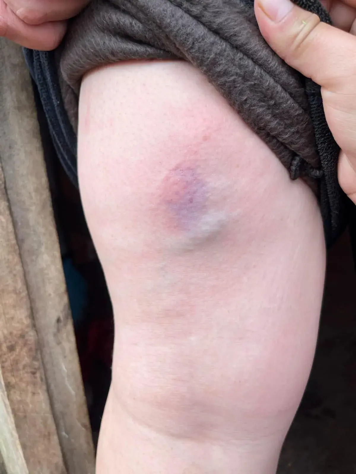 Moradores  da TI Votouro relatam terem sido atacados com pedras, pedaços de pau e jatos spray de pimenta durante confronto com a polícia