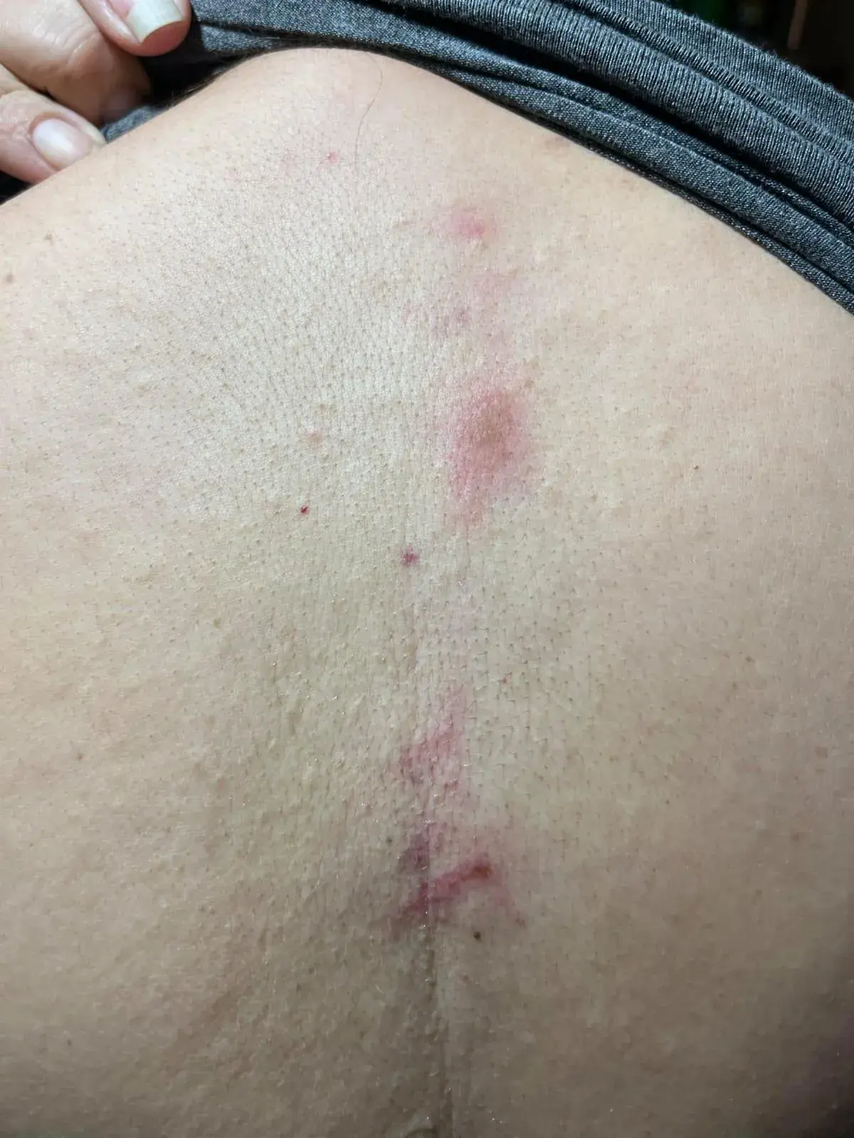 Moradores  da TI Votouro relatam terem sido atacados com pedras, pedaços de pau e jatos spray de pimenta durante confronto com a polícia